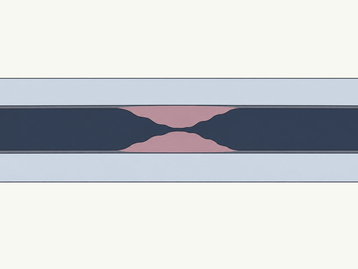 Drawing, not to scale: a leg artery narrowed by fatty plaque